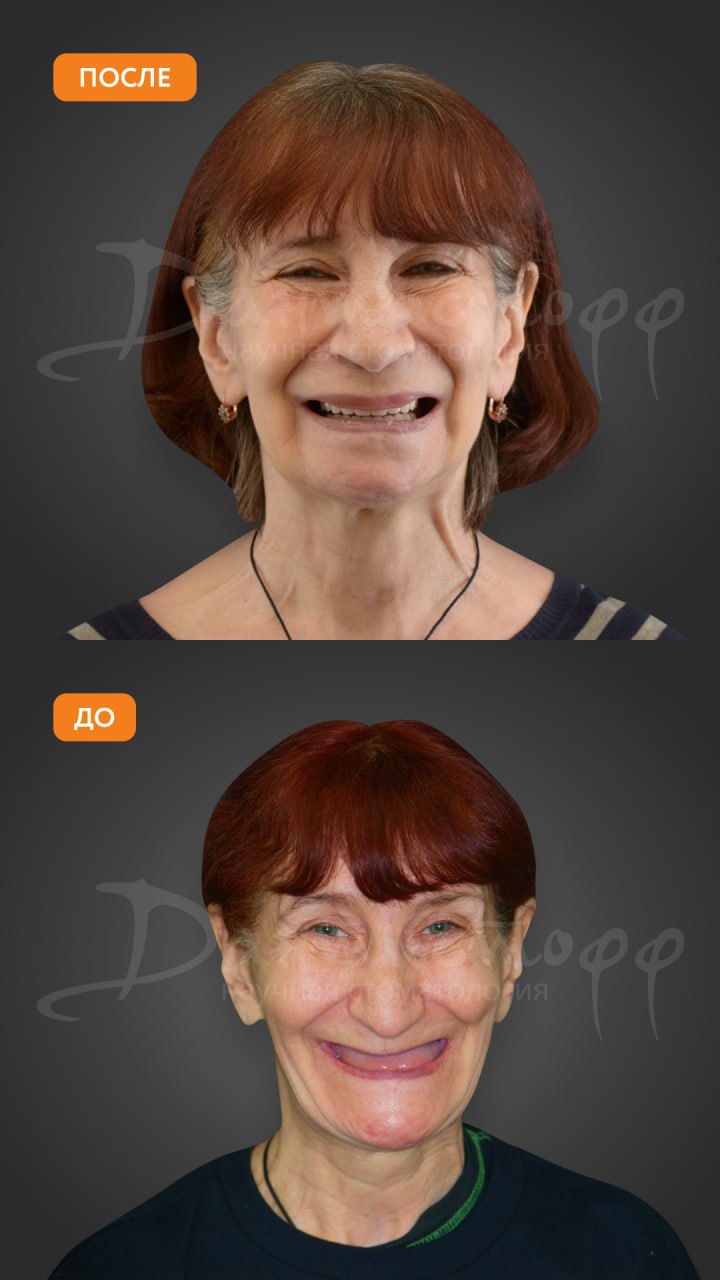 Заголовок